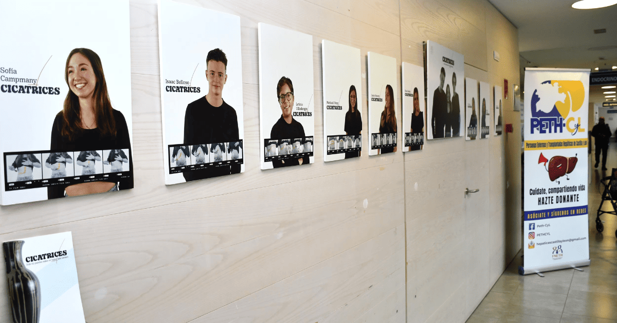 Exposición 'El valor de las cicatrices' en el Hospital Río Carrión - Palencia'.